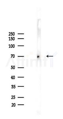 Phospho-YAP (s397) Antibody - Western blot analysis of lysates from B16F10-LUC cells(UV,30min treatment), using Phospho-YAP (s397) Antibody at 1/1000 dilution.