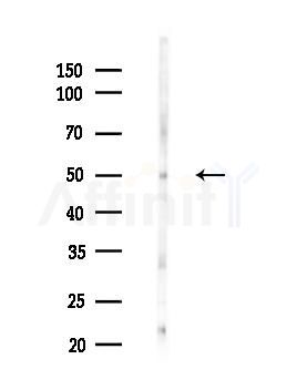 Phospho-HNF4 alpha (Ser304) Antibody - Western blot analysis of lysates from COLO205 cells(UV 30min treatment), using Phospho-HNF4 alpha (Ser304) Antibody at 1/1000 dilution.