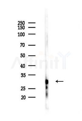 Phospho-AQP2 (Ser269) Antibody - Western blot analysis of lysates from PC12 cells(LPS 4h treatment), using Phospho-AQP2 (Ser269) Antibody at 1/1000 dilution.