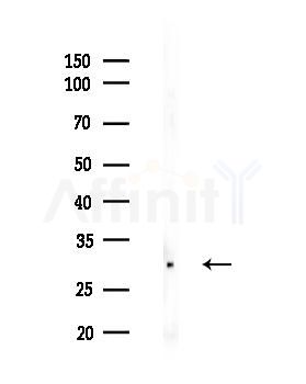 Phospho-AQP2 (Ser269) Antibody - Western blot analysis of lysates from COLO205 cells(UV 30min treatment), using Phospho-AQP2 (Ser269) Antibody at 1/1000 dilution.