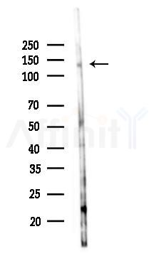 Phospho-VEGFR3 (Tyr1230) Antibody - Western blot analysis of lysates from 293 cells(LPS 4h treatment), using Phospho-VEGFR3 (Tyr1230) Antibody at 1/1000 dilution.
