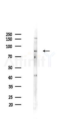 Phospho-beta Catenin (Tyr670) Antibody - Western blot analysis of lysates from B16F10-LUC cells(UV,30min treatment), using Phospho-beta Catenin (Tyr670) Antibody at 1/1000 dilution.