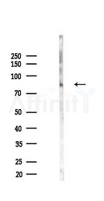 Phospho-beta Catenin (y654) Antibody - Western blot analysis of lysates from B16F10-LUC cells(UV,30min treatment), using Phospho-beta Catenin (y654) Antibody at 1/1000 dilution.