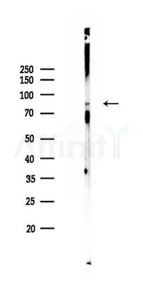 Phospho-beta Catenin (y654) Antibody - Western blot analysis of lysates from Mouse liver, using Phospho-beta Catenin (y654) Antibody at 1/1000 dilution.