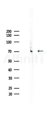Phospho-CD50/ICAM-3 (Ser518) Antibody - Western blot analysis of lysates from A2780 cells(UV,30min treatment), using Phospho-CD50/ICAM-3 (Ser518) Antibody at 1/1000 dilution.