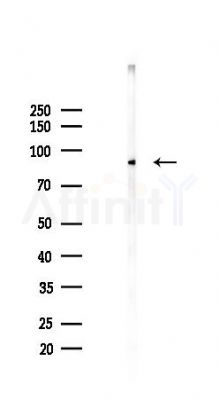 Phospho-CD171/N-CAML1 (Ser1181) Antibody - Western blot analysis of lysates from B16F10-LUC cells(UV,30min treatment), using Phospho-CD171/N-CAML1 (Ser1181) Antibody at 1/1000 dilution.