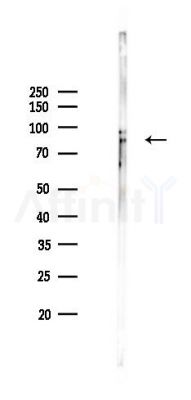 Phospho-CD171/N-CAML1 (Ser1181) Antibody - Western blot analysis of lysates from Mouse liver, using Phospho-CD171/N-CAML1 (Ser1181) Antibody at 1/1000 dilution.