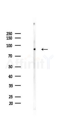 Phospho-CD171/N-CAML1 (Ser1181) Antibody - Western blot analysis of lysates from A2780 cells(UV,30min treatment), using Phospho-CD171/N-CAML1 (Ser1181) Antibody at 1/1000 dilution.