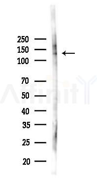 Phospho-JAK1 (Tyr1034/Tyr1035) Antibody - Western blot analysis of lysates from 293 cells(LPS 4h treatment), using Phospho-JAK1 (Tyr1034/Tyr1035) Antibody at 1/1000 dilution.
