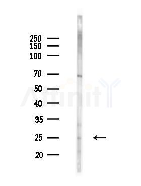 Phospho-Rab3A (Thr86) Antibody - Western blot analysis of lysates from Mouse brain, using Phospho-Rab3A (Thr86) Antibody at 1/1000 dilution.