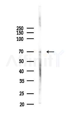 Phospho-Synapsin I (Ser62/Ser67) Antibody - Western blot analysis of lysates from A2780 cells(starvation, 24h treatment), using Phospho-Synapsin I (Ser62/Ser67) Antibody at 1/1000 dilution.