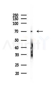 Phospho-Moesin/Ezrin/Radixin (Thr558) Antibody - Western blot analysis of lysates from Mouse brain, using Phospho-Moesin/Ezrin/Radixin (Thr558) Antibody at 1/1000 dilution.