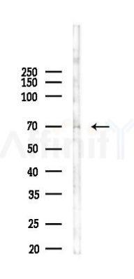 Phospho-SRF (Ser77) Antibody - Western blot analysis of lysates from A2780 cells(starvation, 24h treatment), using Phospho-SRF (Ser77) Antibody at 1/1000 dilution.
