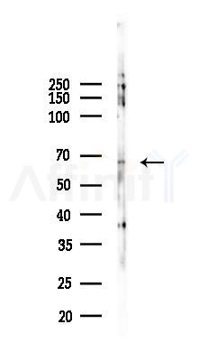 Phospho-HSP60 (Ser70) Antibody - Western blot analysis of lysates from A2780 cells(starvation, 24h treatment), using Phospho-HSP60 (Ser70) Antibody at 1/1000 dilution.