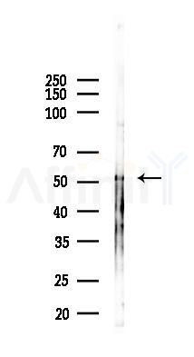 Phospho-p53 (Ser6) Antibody - Western blot analysis of lysates from A2780 cells(starvation, 24h treatment), using Phospho-p53 (Ser6) Antibody at 1/1000 dilution.