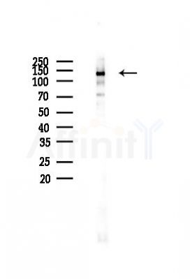 Phospho-Bub1 (Ser459) Antibody - Western blot analysis of lysates from PC12 cells(LPS 4h treatment), using Phospho-Bub1 (Ser459) Antibody at 1/1000 dilution.