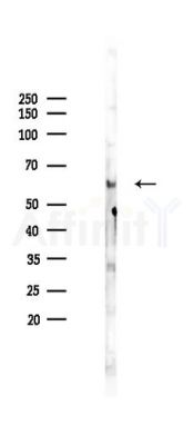 Phospho-SMAD6 (Ser435) Antibody - Western blot analysis of lysates from Mouse brain, using Phospho-SMAD6 (Ser435) Antibody at 1/1000 dilution.