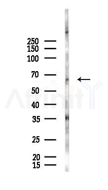 Acetyl-FOXO3A (Lys290) Antibody - Western blot analysis of lysates from Hela cells(starvation 24h treatment), using Acetyl-FOXO3A (Lys290) Antibody at 1/1000 dilution.