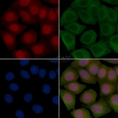 Acetyl-FOXO3A (Lys290) Antibody - AF3770 staining Hela cells(45min of heat-shock treatment) by IF/ICC.