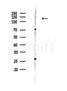 Phospho-MYPT1 (Ser852) Antibody - Western blot analysis of lysates from COLO205 cells(starvation 24h treatment), using Phospho-MYPT1 (Ser852) Antibody at 1/1000 dilution.