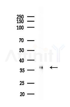 Phospho-SCD1 (Tyr55) Antibody - Western blot analysis of lysates from A2780 cells(starvation, 24h treatment), using Phospho-SCD1 (Tyr55) Antibody at 1/1000 dilution.