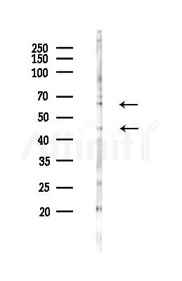Phospho-SGK1 (Ser78) Antibody - Western blot analysis of lysates from COLO205 cells(starvation 24h treatment), using Phospho-SGK1 (Ser78) Antibody at 1/1000 dilution.