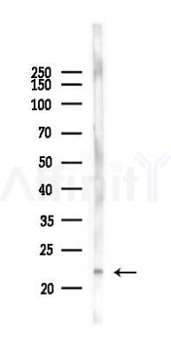 Phospho-p23 (Ser113) Antibody - Western blot analysis of lysates from B16F10-LUC cells(heat-shock 45min treatment), using Phospho-p23 (Ser113) Antibody at 1/1000 dilution.
