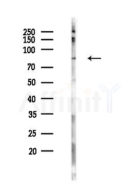 Phospho-beta Catenin (Tyr654) Antibody - Western blot analysis of lysates from COLO205 cells(starvation 24h treatment), using Phospho-beta Catenin (Tyr654) Antibody at 1/1000 dilution.