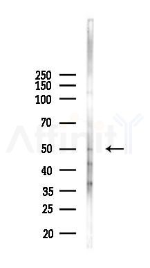 Phospho-ARRB1 (Ser412) Antibody - Western blot analysis of lysates from A2780 cells(starvation, 24h treatment), using Phospho-ARRB1 (Ser412) Antibody at 1/1000 dilution.