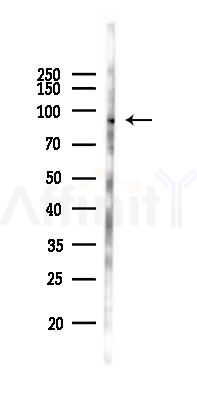 Phospho-RSK1 p90 (Thr348) Antibody - Western blot analysis of lysates from B16F10-LUC cells(heat-shock 45min treatment), using Phospho-RSK1 p90 (Thr348) Antibody at 1/1000 dilution.