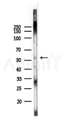 Phospho-HSF1 (Ser326) Antibody - Western blot analysis of lysates from Hela cells(starvation 24h treatment), using Phospho-HSF1 (Ser326) Antibody at 1/1000 dilution.