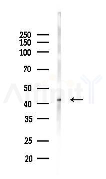 Phospho-BCKDHA (Ser292/Ser337) Antibody - Western blot analysis of lysates from Mouse brain, using Phospho-BCKDHA (Ser292/Ser337) Antibody at 1/1000 dilution.