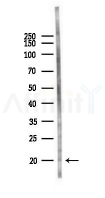 Phospho-MLC2 (Ser19) Antibody - Western blot analysis of lysates from B16F10-LUC cells(heat-shock 45min treatment), using Phospho-MLC2 (Ser19) Antibody at 1/1000 dilution.