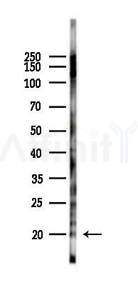 Phospho-Histone H3 (Thr3) Antibody - Western blot analysis of lysates from B16F10-LUC cells(heat-shock 45min treatment), using Phospho-Histone H3 (Thr3) Antibody at 1/1000 dilution.