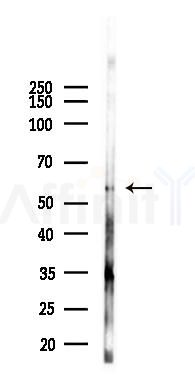 Phospho-HBP1 (Ser402) Antibody - Western blot analysis of lysates from PC12 cells(starvation,24h treatment), using Phospho-HBP1 (Ser402) Antibody at 1/1000 dilution.
