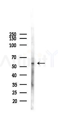 Phospho-HBP1 (Ser402) Antibody - Western blot analysis of lysates from B16F10-LUC cells(UV,30min treatment), using Phospho-HBP1 (Ser402) Antibody at 1/1000 dilution.