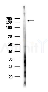 Phospho-LRP6 (Thr1493) Antibody - Western blot analysis of lysates from Hela cells(starvation 24h treatment), using Phospho-LRP6 (Thr1493) Antibody at 1/1000 dilution.