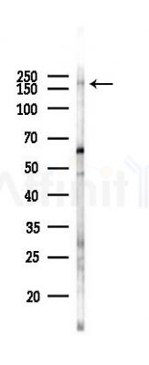 Phospho-LRP6 (Ser1420) Antibody - Western blot analysis of lysates from B16F10-LUC cells(heat-shock 45min treatment), using Phospho-LRP6 (Ser1420) Antibody at 1/1000 dilution.