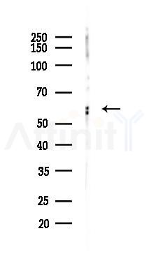 Phospho-RUNX2 (Ser465) Antibody - Western blot analysis of lysates from 293 cells(LPS 4h treatment), using Phospho-RUNX2 (Ser465) Antibody at 1/1000 dilution.