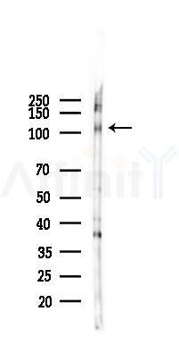 Phospho-PSD95 (Thr19) Antibody - Western blot analysis of lysates from B16F10-LUC cells(UV,30min treatment), using Phospho-PSD95 (Thr19) Antibody at 1/1000 dilution.
