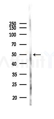 Phospho-Parkin (Ser131) Antibody - Western blot analysis of lysates from B16F10-LUC cells(heat-shock 45min treatment), using Phospho-Parkin (Ser131) Antibody at 1/1000 dilution.