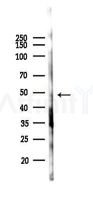 Phospho-Parkin (Ser131) Antibody - Western blot analysis of lysates from Hela cells(starvation 24h treatment), using Phospho-Parkin (Ser131) Antibody at 1/1000 dilution.