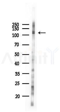 Phospho-Transferrin Receptor (Tyr20) Antibody - Western blot analysis of lysates from B16F10-LUC cells(heat-shock 45min treatment), using Phospho-Transferrin Receptor (Tyr20) Antibody at 1/1000 dilution.