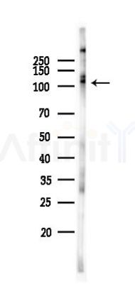 Phospho-Transferrin Receptor (Tyr20) Antibody - Western blot analysis of lysates from Hela cells(starvation 24h treatment), using Phospho-Transferrin Receptor (Tyr20) Antibody at 1/1000 dilution.