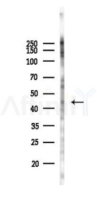 Phospho-RIP3 (Thr231/Ser232) Antibody - Western blot analysis of lysates from B16F10-LUC cells(heat-shock 45min treatment), using Phospho-RIP3/RIPK3 (Thr231/Ser232) Antibody at 1/1000 dilution.