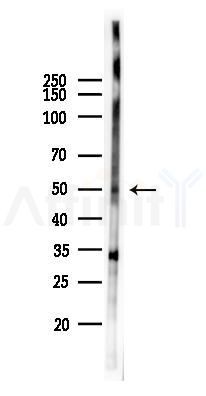 Phospho-MLKL (Ser352) Antibody - Western blot analysis of lysates from Hela cells(starvation 24h treatment), using Phospho-MLKL (Ser352) Antibody at 1/1000 dilution.