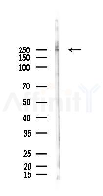 Phospho-ATR (Ser428) Antibody - Western blot analysis of lysates from Mouse testis, using Phospho-ATR (Ser428) Antibody at 1/1000 dilution.
