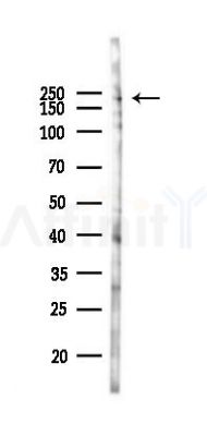 Phospho-CAD (Thr456) Antibody - Western blot analysis of lysates from B16F10-LUC cells(heat-shock 45min treatment), using Phospho-CAD (Thr456) Antibody at 1/1000 dilution.