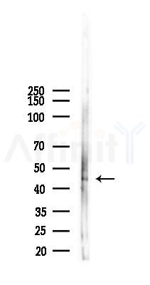 Phospho-NCF1/p47-phox (Ser345) Antibody - Western blot analysis of lysates from B16F10-LUC cells(UV,30min treatment), using Phospho-NCF1/p47-phox (Ser345) Antibody at 1/1000 dilution.