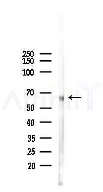 Phospho-CRMP2 (Thr509) Antibody - Western blot analysis of lysates from B16F10-LUC cells(UV,30min treatment), using Phospho-CRMP2 (Thr509) Antibody at 1/1000 dilution.